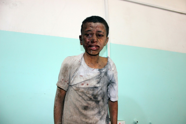 yemen kid attack