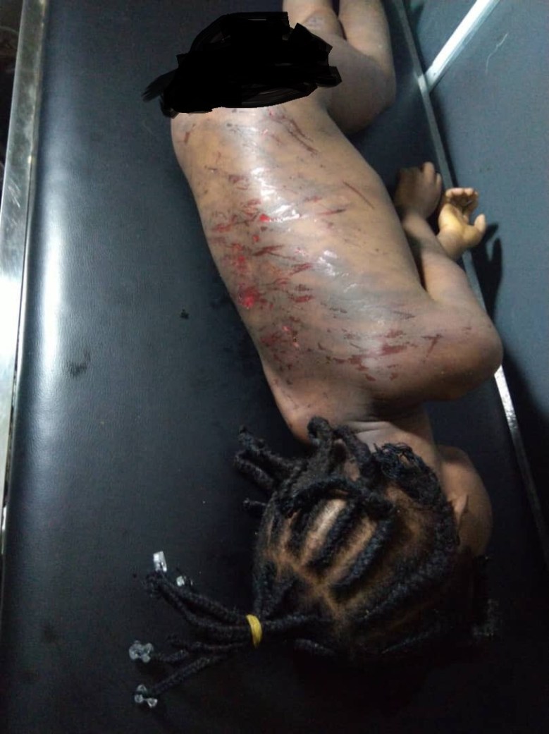 Lifless-body-of-the-little-girl